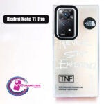 Case Redmi Note11Pro